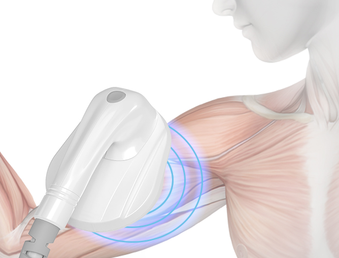 Aparat Profesional de Remodelare corporala prin Stimulare Musculara – tehnologie HIPEM (High Intensity Pulsed ElectroMagnetic)